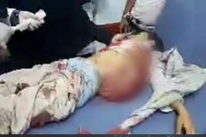 بينهم طفل.. استشهاد وإصابة 4 مدنيين بتعز في قصف للحوثيين