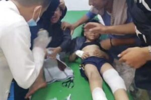 إصابة 12 طفل في قصف حوثي شمال تعز