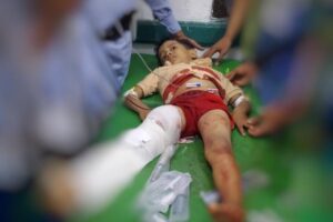 وفاة أحد الأطفال المصابين بالقصف الحوثي في تعز