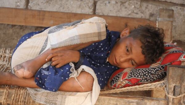 مقتل وإصابة 128 مدنياً جراء الألغام الحوثية منذ مطلع العام الجاري