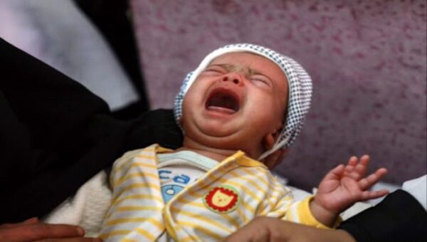 تسجيل 11 حالة إصابة جديدة بشلل الأطفال في مناطق سيطرة الحوثي
