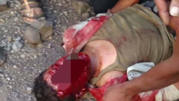 انفجار لغم حوثي يصيب شاباً بجروح خطيرة غرب تعز
