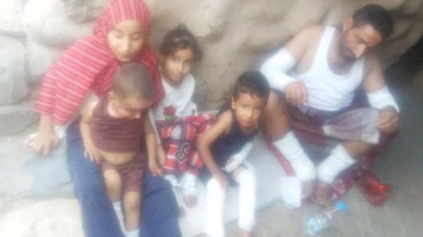إب  ‫احتراق أسرة كاملة إثر انفجار أسطوانة غاز