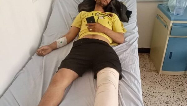 الضالع  إصابة مواطن برصاص قناص حوثي في منطقة حمر السادة