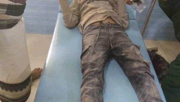 إصابة طفلين بشظايا قصف حوثي على أحياء تعز السكنية