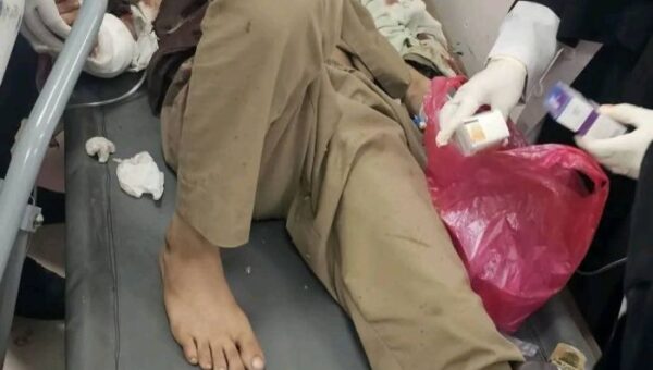 بالأسماء.. “اليمن اليوم” تنشر قائمة ضحايا التفجير الدامي في تعز