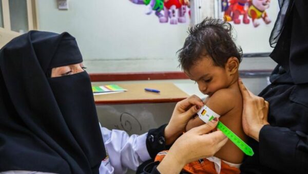 15 مليون يورو من ألمانيا للحد من سوء التغذية في أربع محافظات يمنية