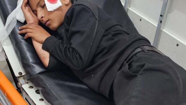 إصابة طفل برصاص قناص حوثي في منطقة “الشقب” بتعز