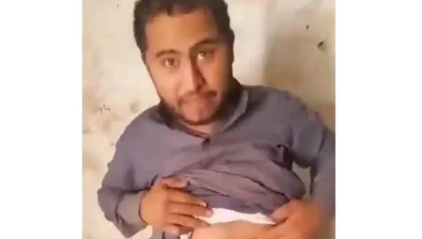 مواطن بصعدة يكشف تعرضه للتعذيب وتلفيق تهمة “تجارة الحشيش”