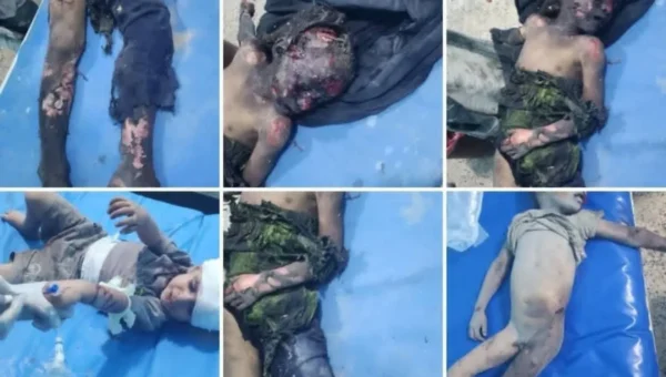 مقتل طفلين وإصابة 15 في قصف حوثي على مخيم نازحين بمأرب